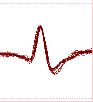 Scope view of template match 1